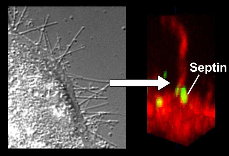 Diarrhoea pathogen modifies the surface of intestinal cells, enabling bacteria to colonize it more easily