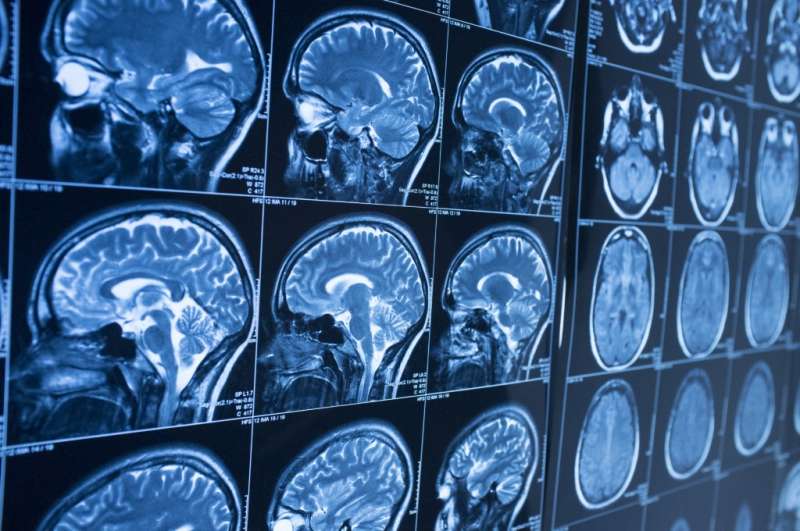 Difficult decisions involving perception increase activity in brain's insular cortex, study finds