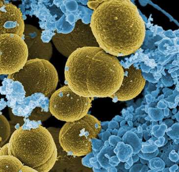 Distinguishing deadly Staph bacteria from harmless strains