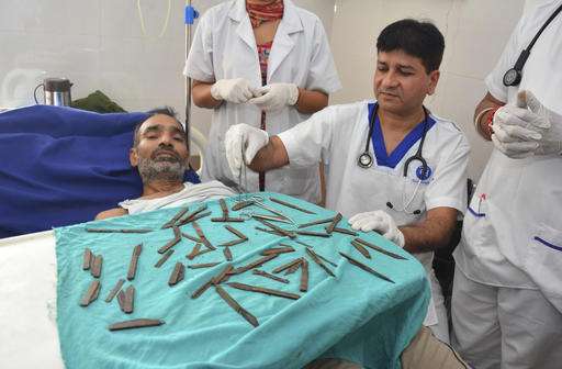 Doctors in India remove 40 knives from man's stomach (Update)