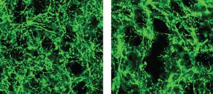 Dopamine neurons have a role in movement, new study finds