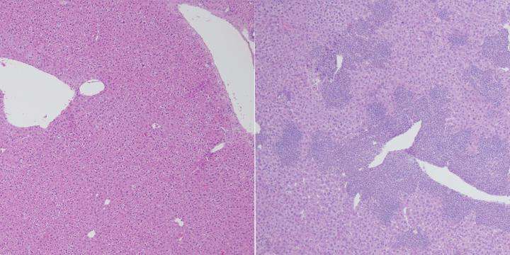 Dual loss of TET proteins prompts lethal upsurge in inflammatory T cells in a mouse model