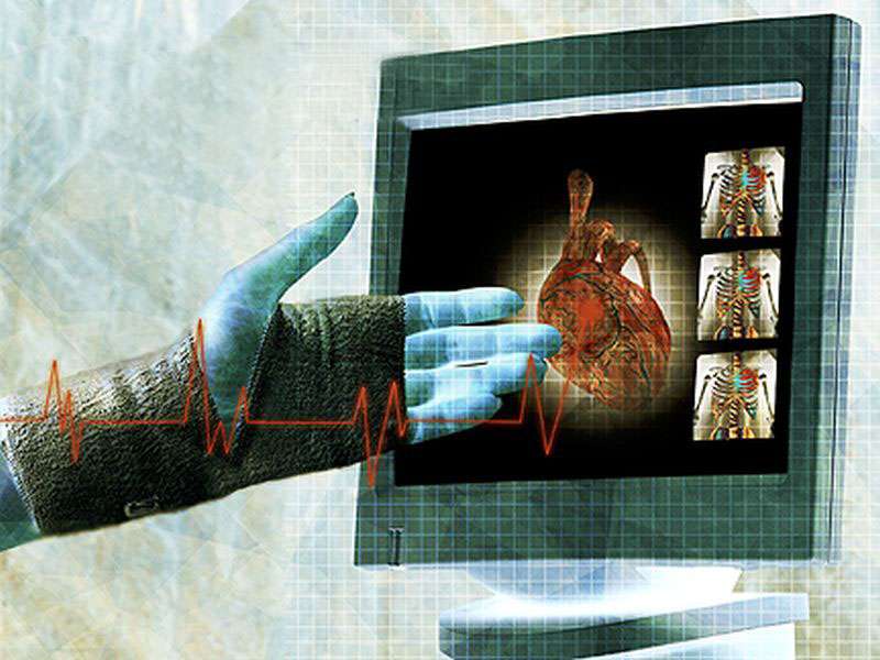 Echo underused during critical cardiovascular hospitalizations