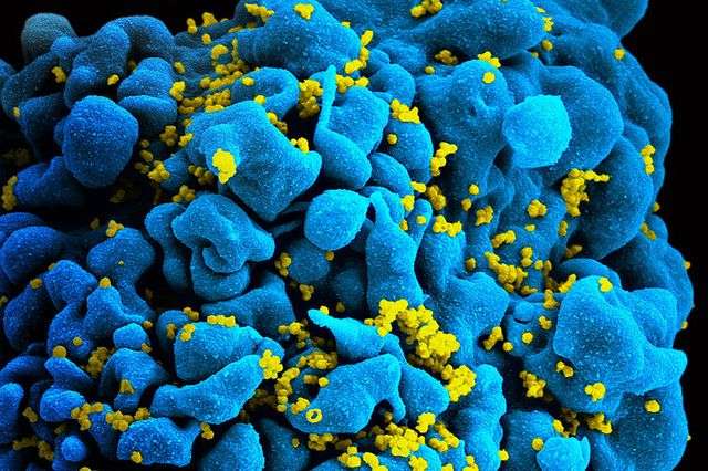 Eliminating HIV is possible; researchers explain how