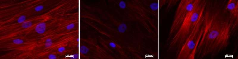 Embryonic gene Nanog reverses aging in adult stem cells