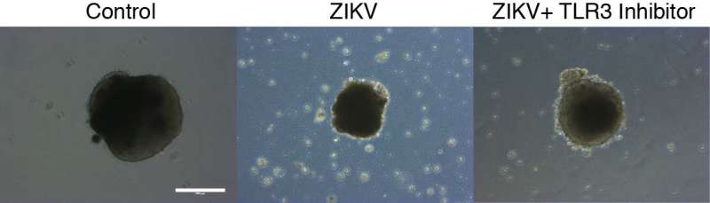 Evidence that Zika causes neural stem cells to self-destruct