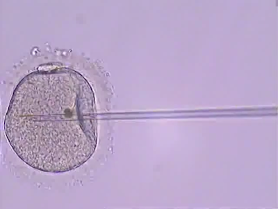 Extra sperm analysis could help involuntarily childless couples