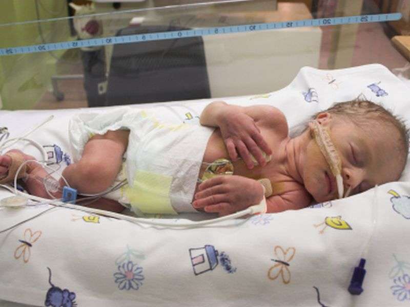 Extreme preemies may be at risk for high blood pressure as adults
