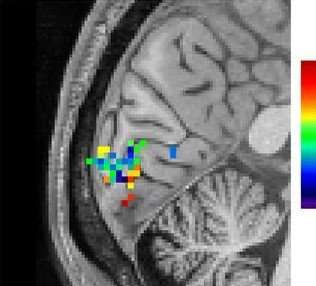 Fast fMRI tracks brain activity during human thought for first time