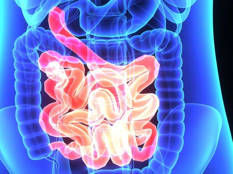Fecal calprotectin levels ID severity of crohn's in small bowel