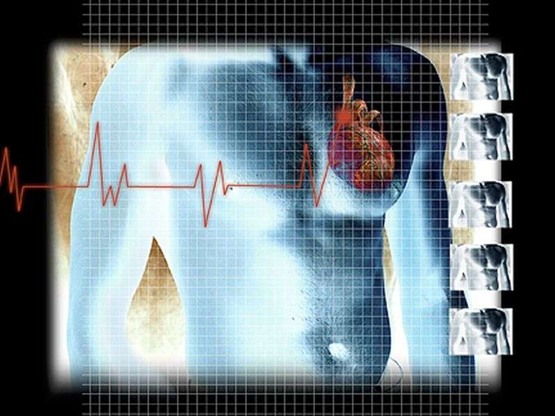 Focused cardiac ultrasonography can discriminate LVSF