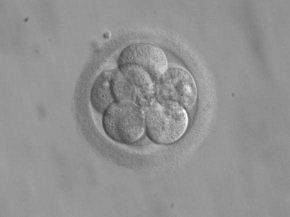 For frozen embryos in dispute, scholars propose guidelines