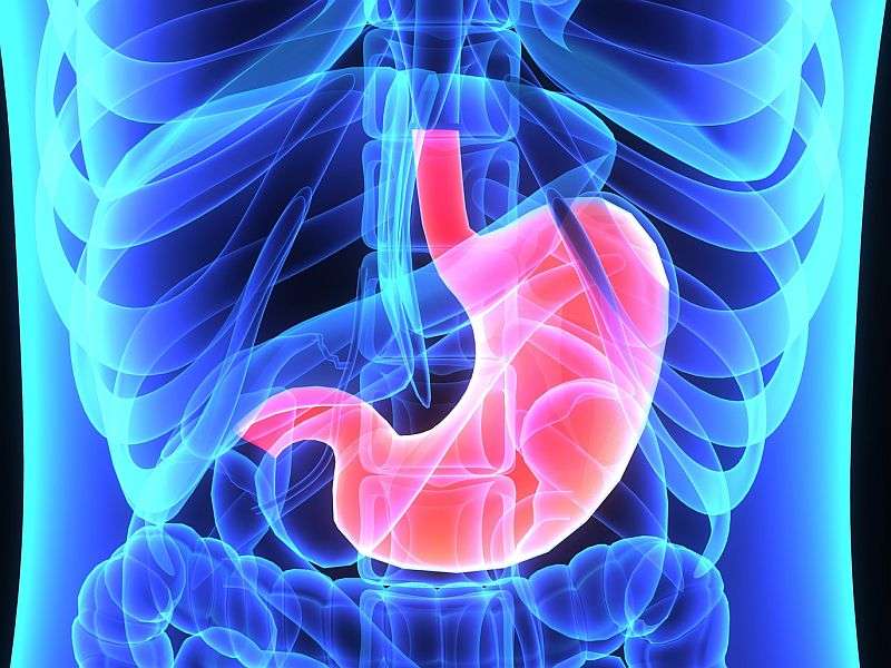 Gastric bypass cuts hormonal responses to hypoglycemia