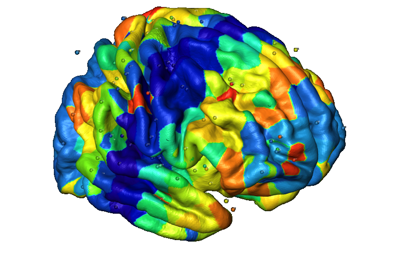 Genetic factors are responsible for creating anatomical patterns in the brain cortex