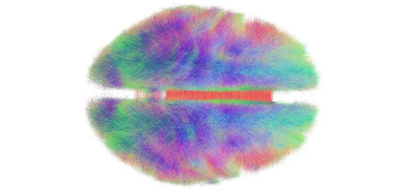 Global brain initiatives generate tsunami of neuroscience data