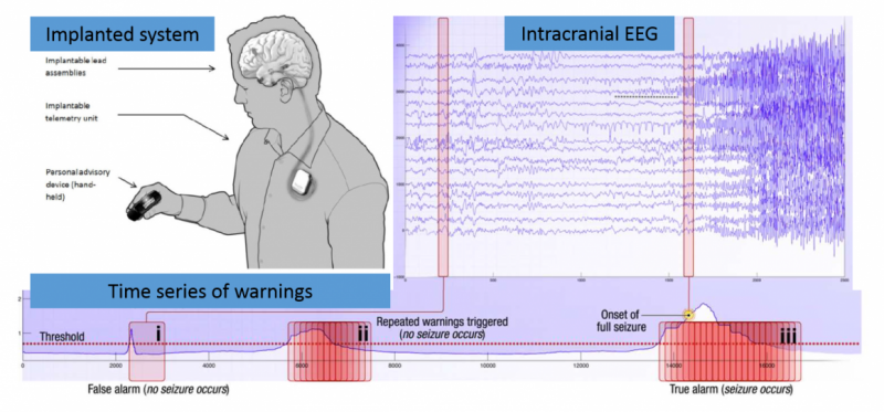 Global crowdsourcing contest to predict epileptic seizures begins