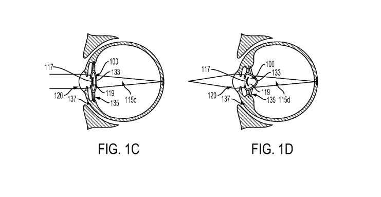 Google patent filing proposes device in eye to address poor vision