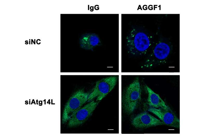 Heart bypass without surgery? -- AGGF1 induces therapeutic angiogenesis through autophagy