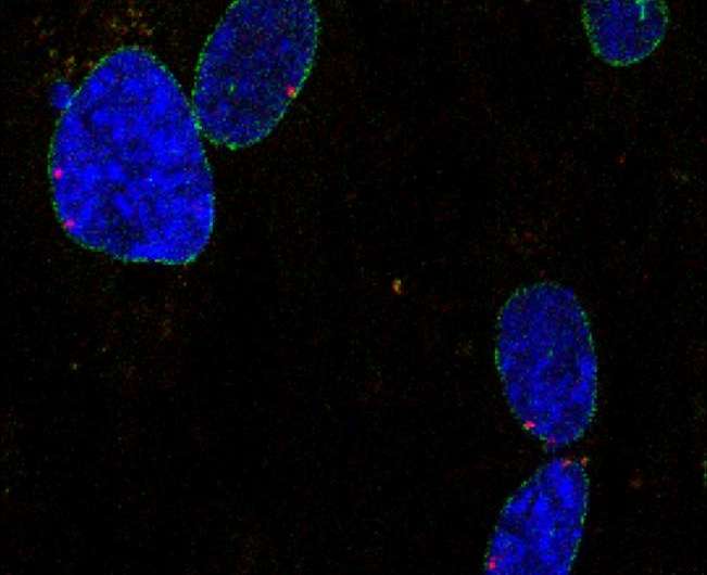 Heart disease, leukemia linked to dysfunction in nucleus