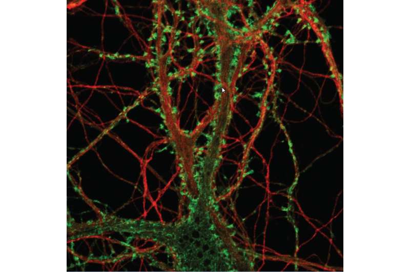 How prions kill neurons: New culture system shows early toxicity to dendritic spines