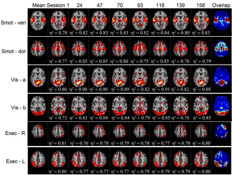 How reliable is resting state fMRI?