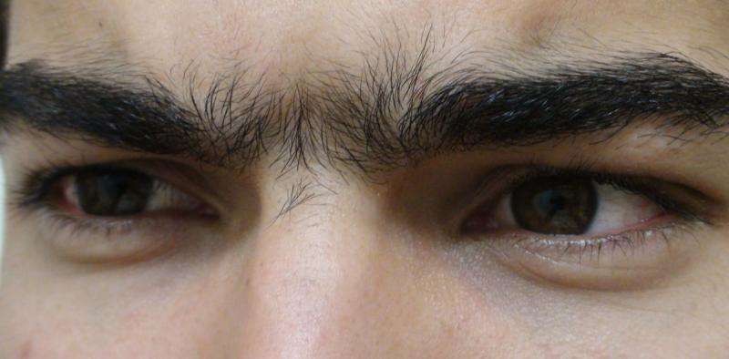 How researchers discovered the genetic origin of the 'unibrow' and other hair traits