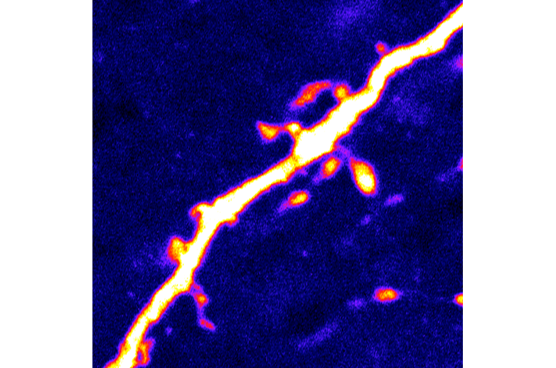 'Hunger' neurons in the brain are regulated by protein activated during fasting