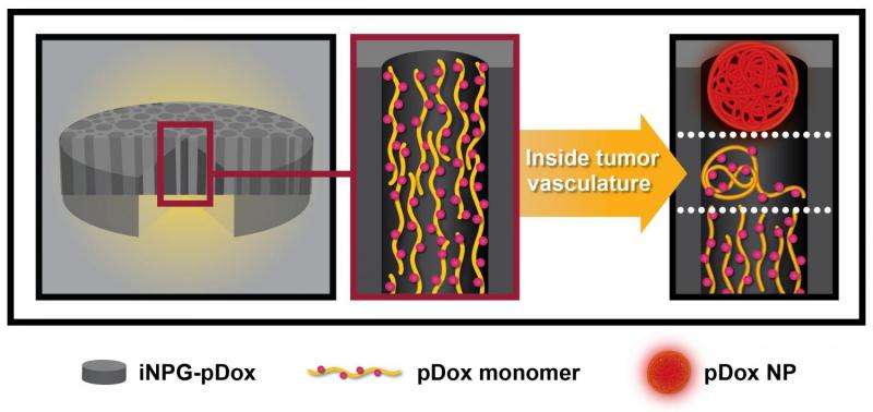 Injectable nanoparticle generator could radically transform metastatic cancer treatment