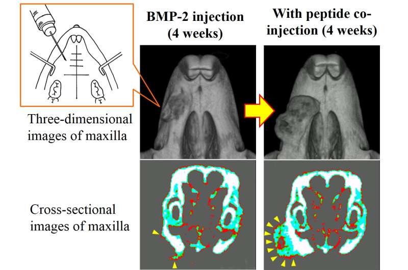 Injected mix of bone-augmenting agents causes new bone growth in mouse jaws