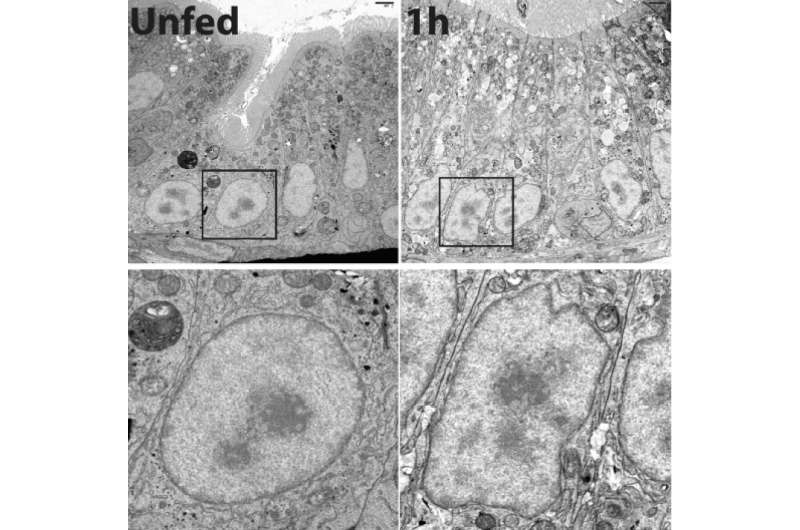 Intestinal cells 'remodel' in response to a fatty meal