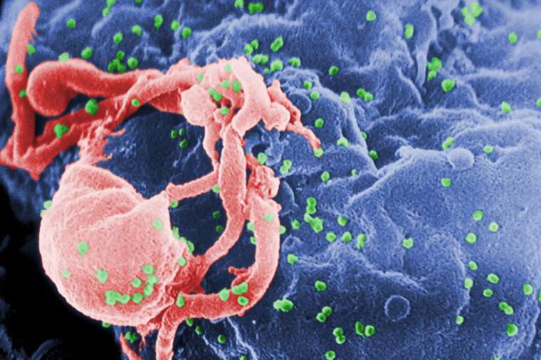 Intestinal microbes may speed progression from HIV to AIDS