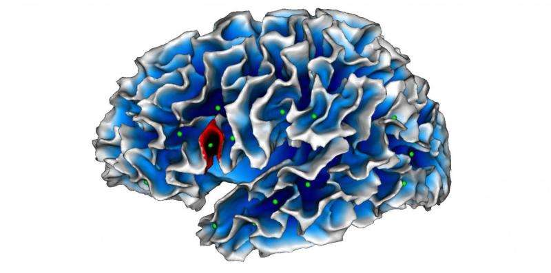 Is autism hiding in a fold of the brain?