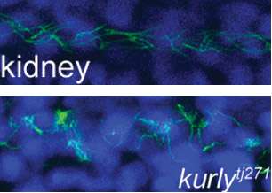 'Kurly' protein keeps cilia moving, oriented in the right direction