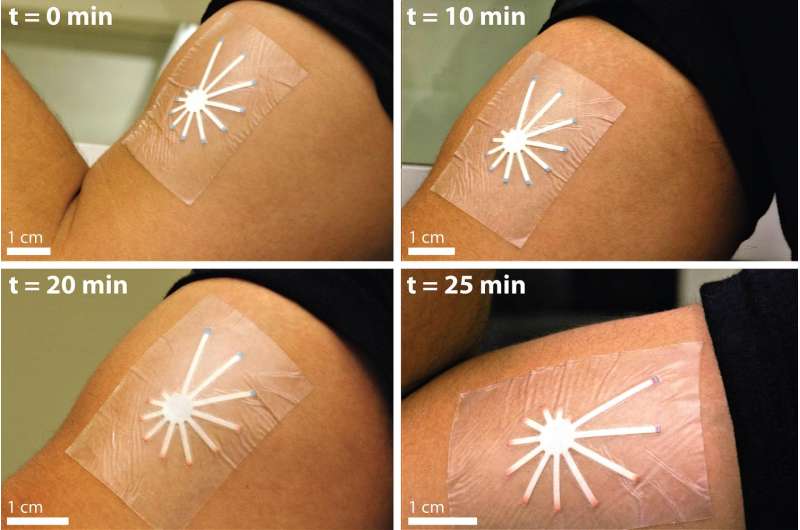 Low-cost paper-based skin patch monitors dehydration by changing color from sweat