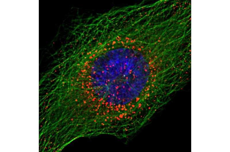 Loyola study reveals how HIV enters cell nucleus