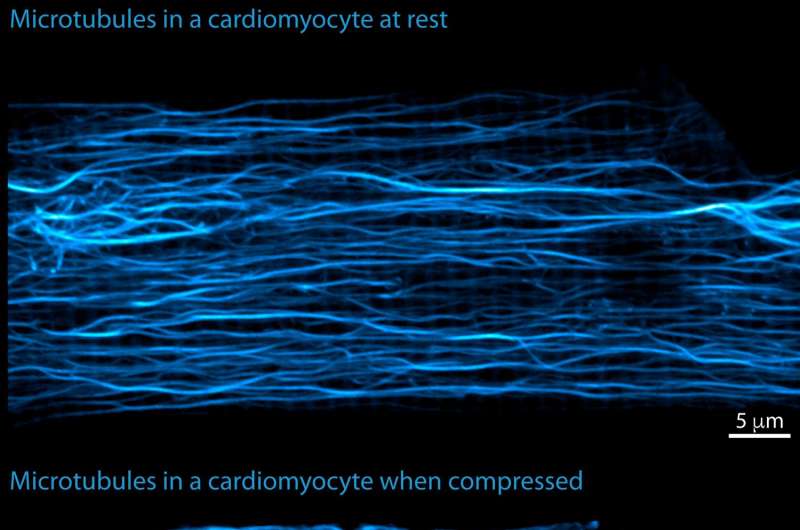 Mechanics of a heartbeat are controlled by molecular strut in heart muscle cells