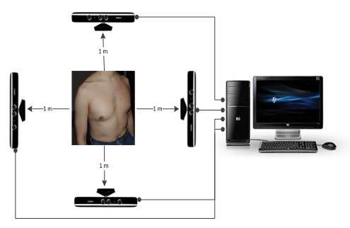 Microsoft's Xbox Kinect breathes new life into respiratory assessment
