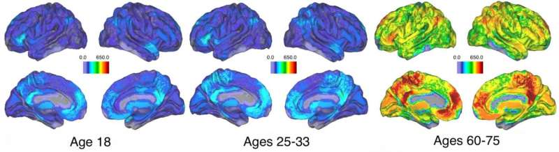 Missed connections: As people age, memory-related brain activity loses cohesion