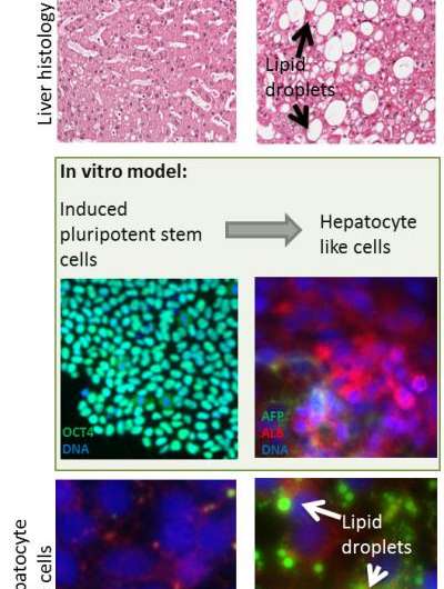 Modeling NAFLD with human pluripotent stem cell derived immature hepatocyte like cells