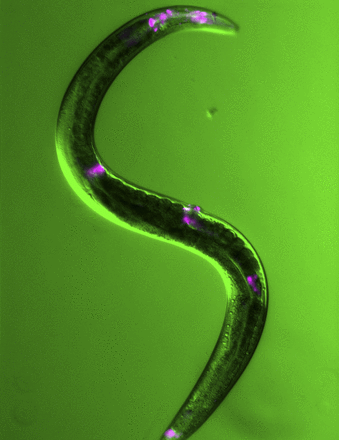 Molecule induces lifesaving sleep in worms