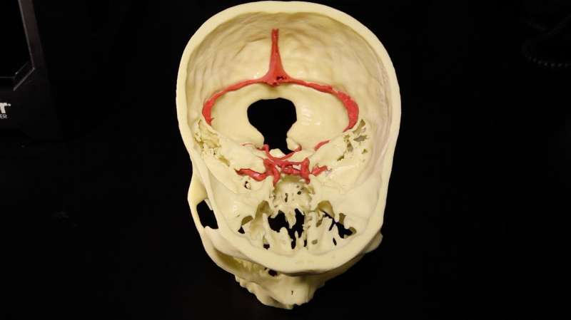 Mount Sinai establishes 3-D printing services for clinicians and researchers