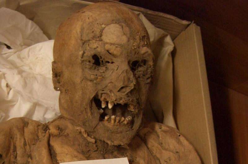 Mutated gene associated with colon cancer discovered in 18th-century Hungarian mummy