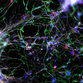 Neurodevelopmental model of Williams syndrome offers insight into human social brain