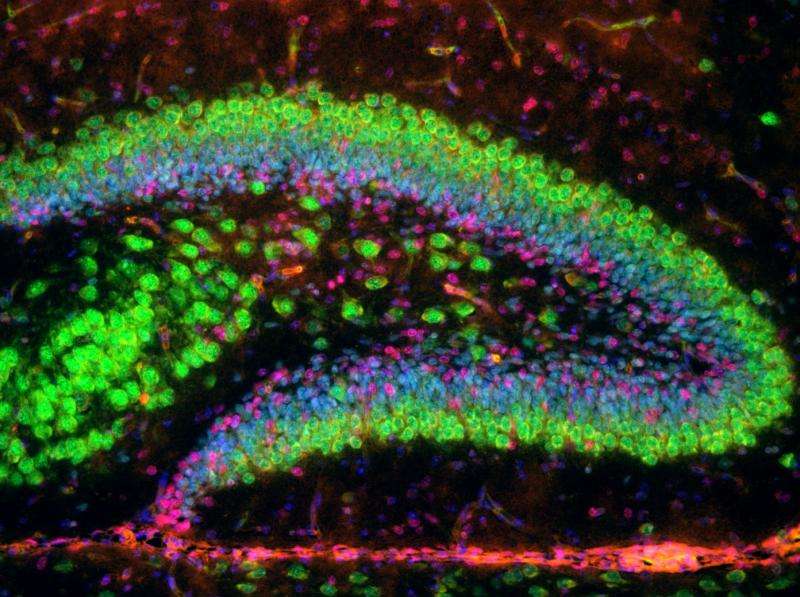 New areas of the brain identified where ALS-implicated gene is active