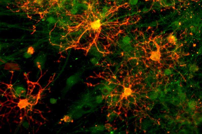 New clues to myelination could help identify ways to intervene in neurodegenerative diseases