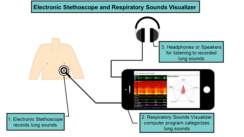 New electronic stethoscope and computer program diagnose lung conditions