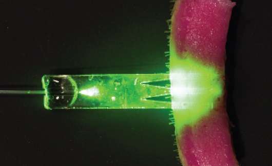 New fibre-optic technology could heal wounds faster