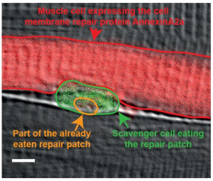 New findings give insight into the cell membrane repair process of torn muscle fibers