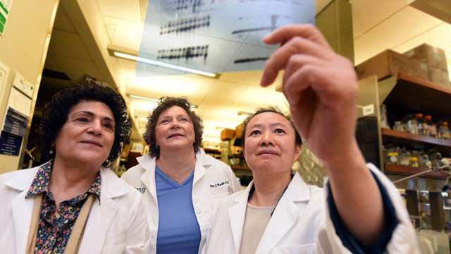 New gene identified as cause, early indicator of breast cancer