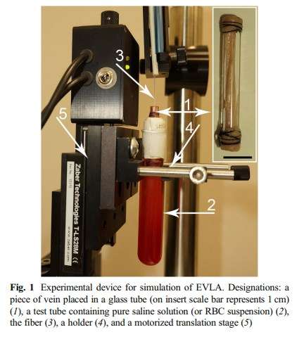 New investigation of endovenous laser ablation of varicose veins